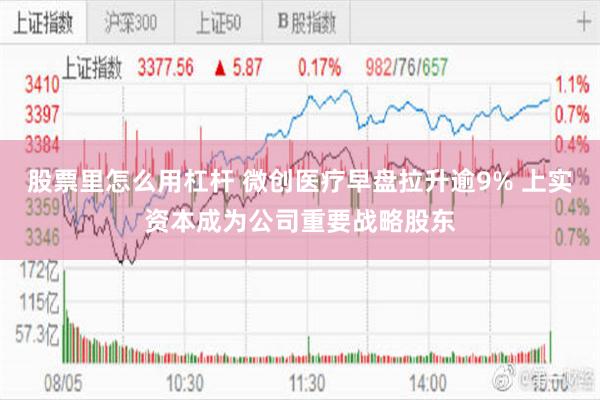 股票里怎么用杠杆 微创医疗早盘拉升逾9% 上实资本成为公司重要战略股东